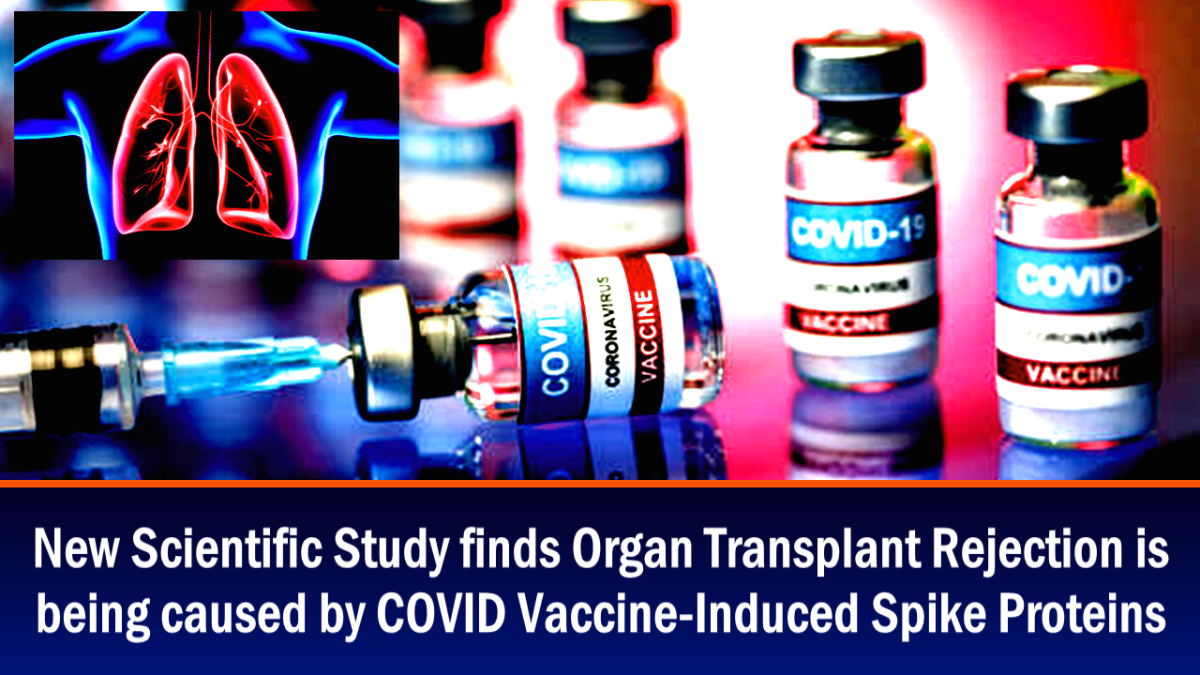 scientific-study-finds-organ-transplant-rejection-is-being-caused-by-covid-vaccine-induced-spike-proteins
