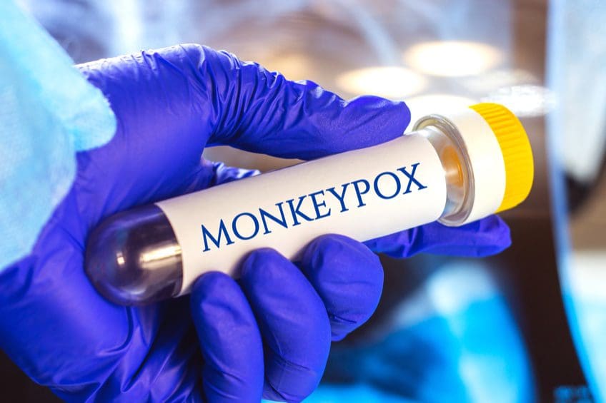 monkeypox-–-stimme-fuer-wissenschaft-und-solidaritaet