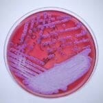 cdc-warnt-vor-toedlichen-bakterien,-die-„bis-zu-50-prozent-der-patienten-toeten“-und-an-der-us-golfkueste-entdeckt-wurden