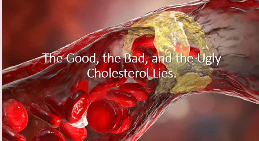 die-guten,-die-schlechten-und-die-haesslichen-luegen-ueber-cholesterin